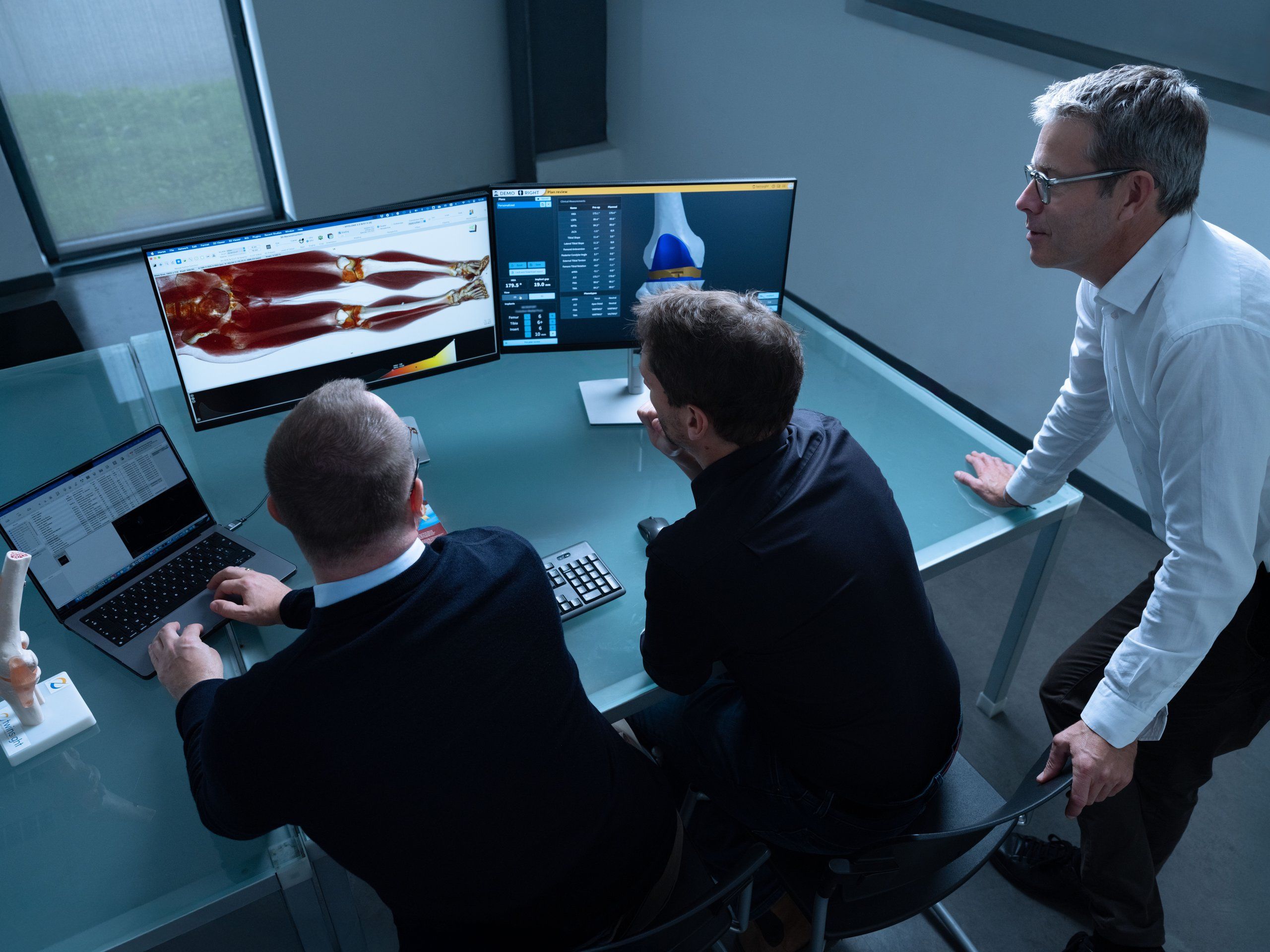 Twinsight engineers reviewing a knee model on two screens