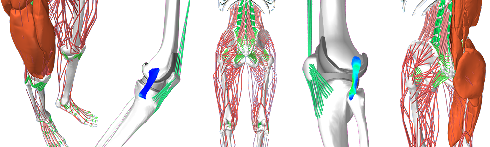 Musculoskeletal models of the lower limb: bones, muscles and ligaments around the hip and the knee, a knee implant in two views